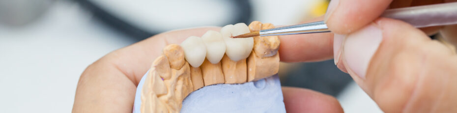 bridging the gap how dental bridges restore your smile